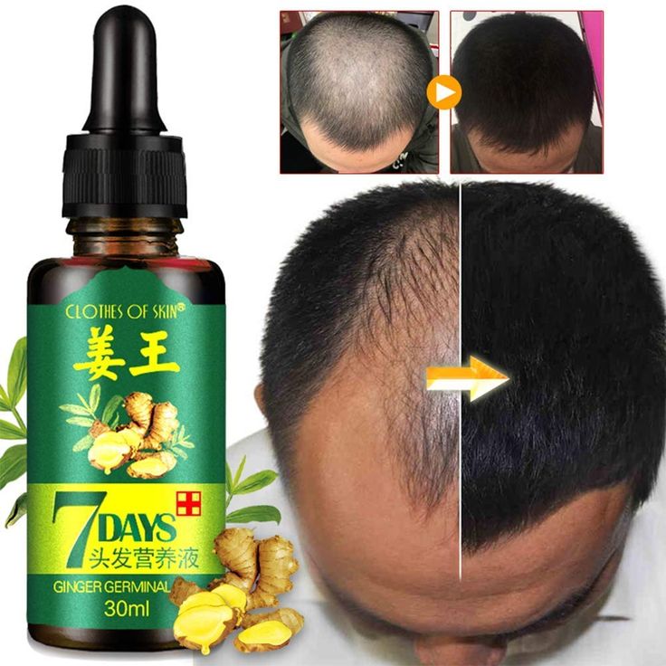 7 days Hair Growth Germinal Oil